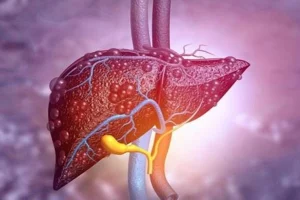 fatty liver